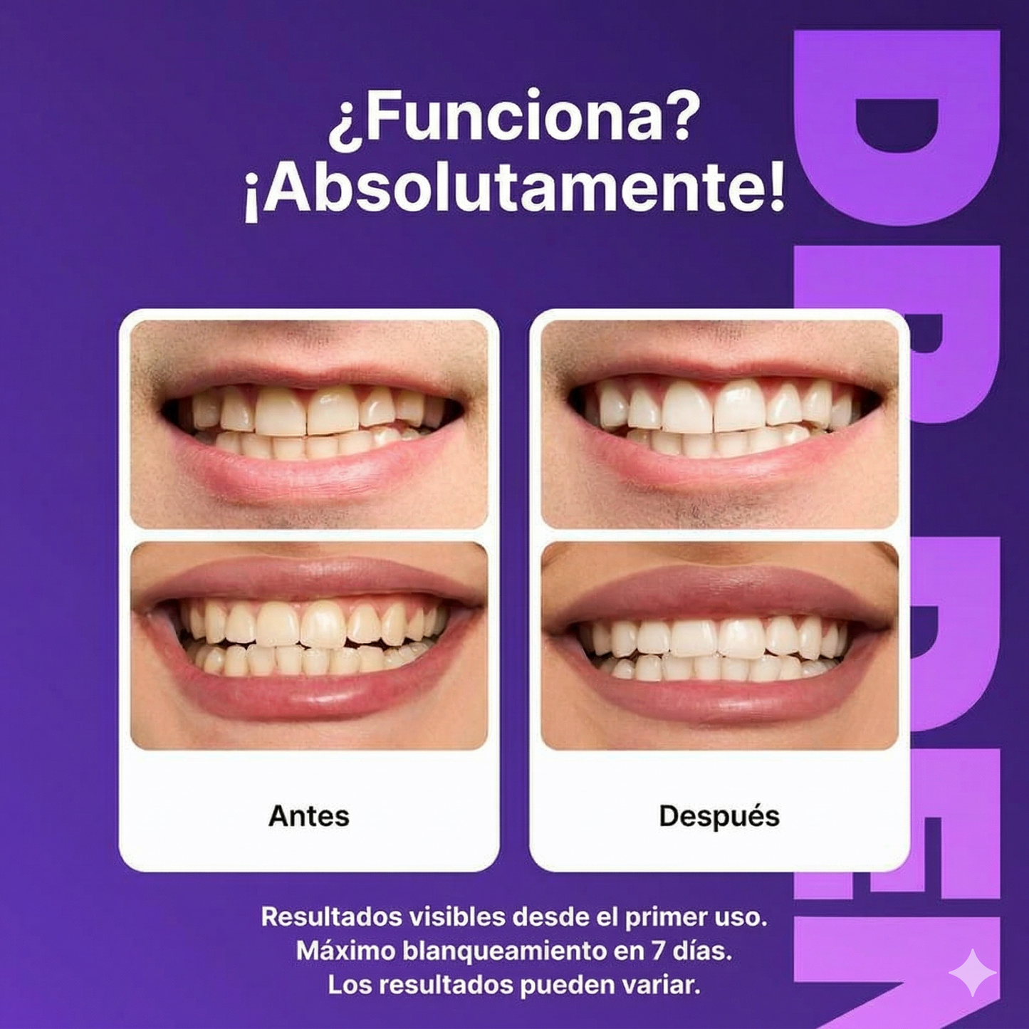 Tiras Blanqueadoras Dentales™